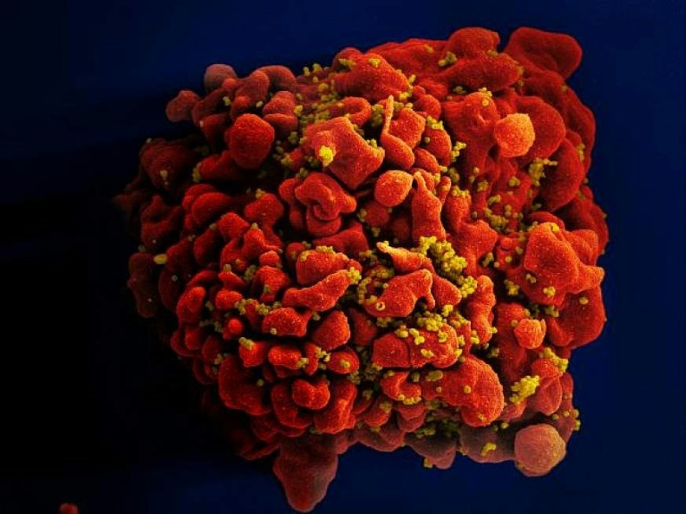 فيروس نقص المناعة البشرية يهاجم خلايا الجهاز المناعي في الجسم (ا ف ب)