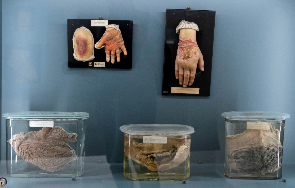 أعضاء بشرية معروضة في متحف التاريخ الطبيعي في فيينا في أكتوبر 2021