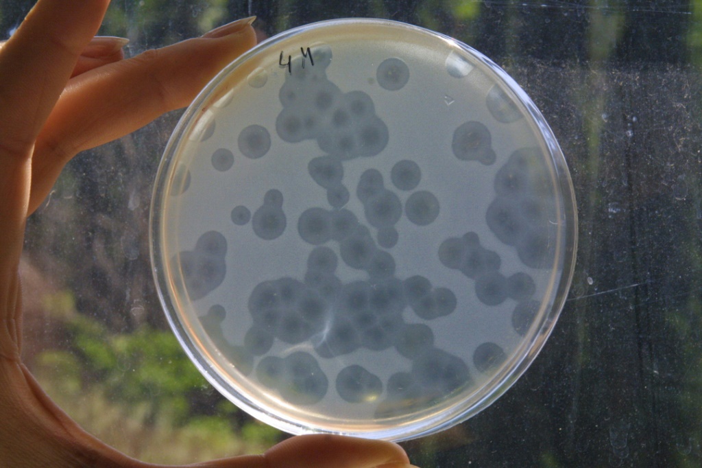 بكتيريا المكورة العنقودية في أحد مختبرات العاصمة الجورجية تبليسي في 23 حزيران/يونيو 2005 (ا ف ب)