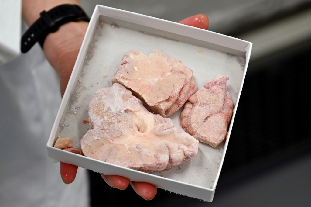 علبة تحوي أجزاء من دماغ بشري في أحد مختبرات كوبنهاغن بتاريخ الثالث من شباط فبراير 2023 (ا ف ب)