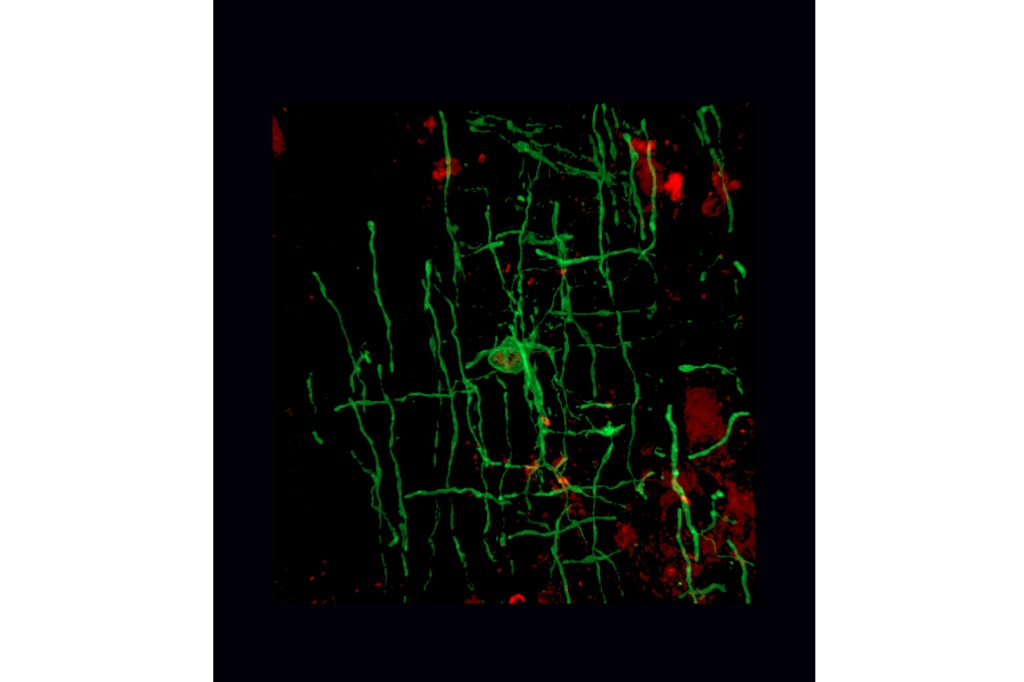 خلايا مسؤولة عن إنتاج الميالين في الجهاز العصبي المركزي (ا ف ب)