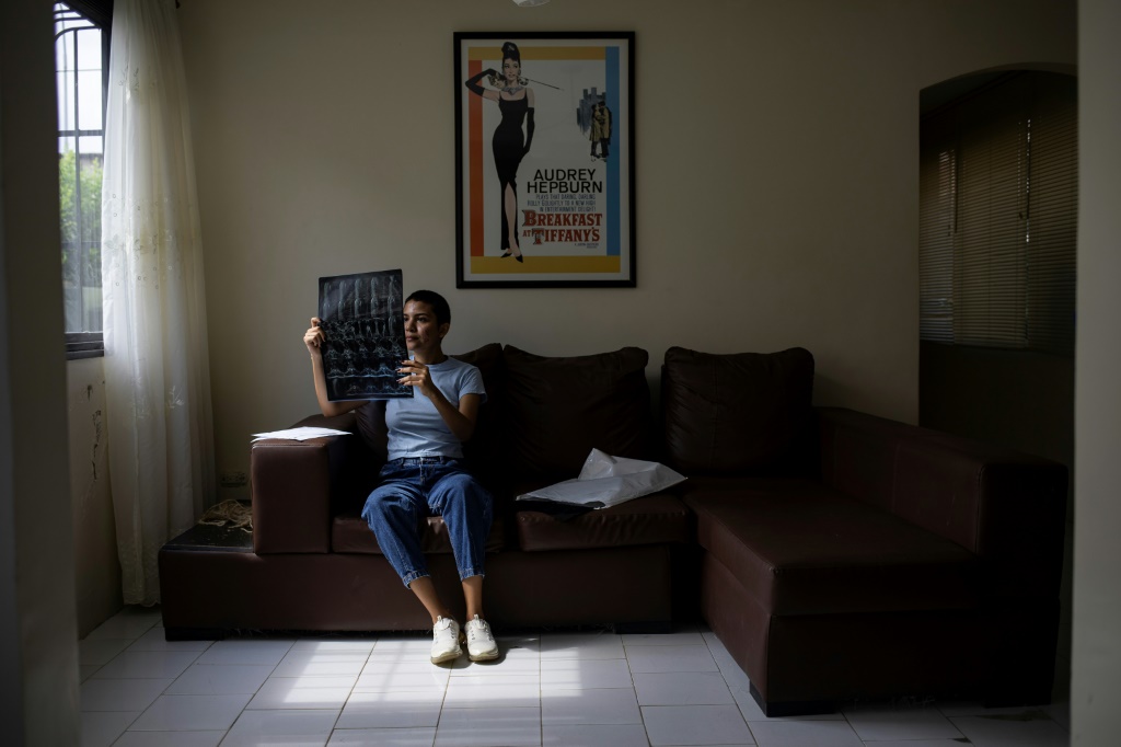 خيمار تواريس (22 عاما)، طالبة في جامعة فنزويلا المركزية مصابة بمرض التصلب اللويحي في منزلها بمنطقة شرايافي الفنزويلية في السادس من شباط/فبراير 2024 (ا ف ب)